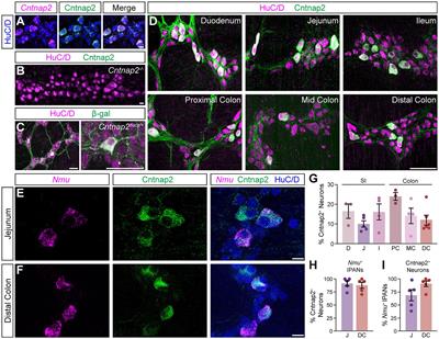 Loss of ASD-related molecule Cntnap2 affects colonic motility in mice